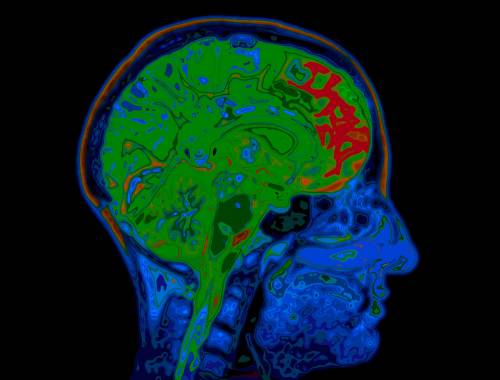 brain-activity-mapping-image-of-default-network-mode brain-activity-mapping-image-of-default-network-mode